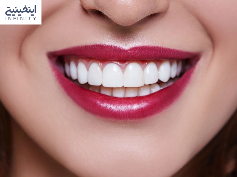 کامپوزیت چیست؟