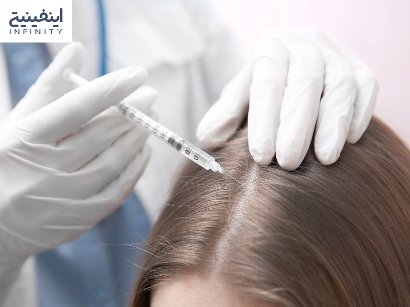 مزوتراپی مو چیست